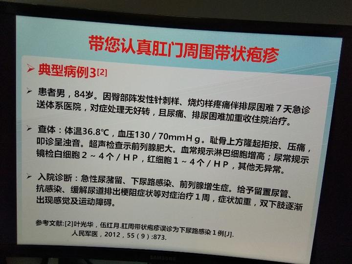 带你认识肛门周围带状疱疹上