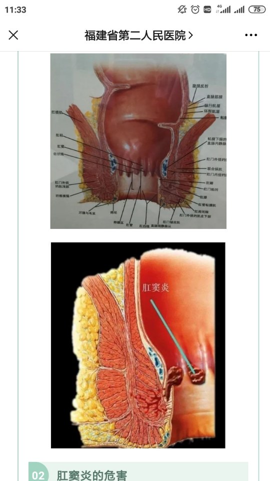 健康科普令人烦恼的肛窦炎