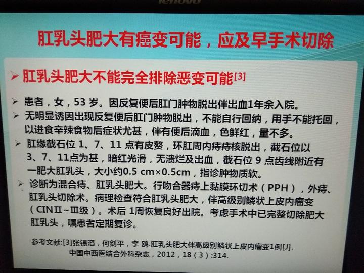 肛乳头肥大有癌变可能建议及早手术切除