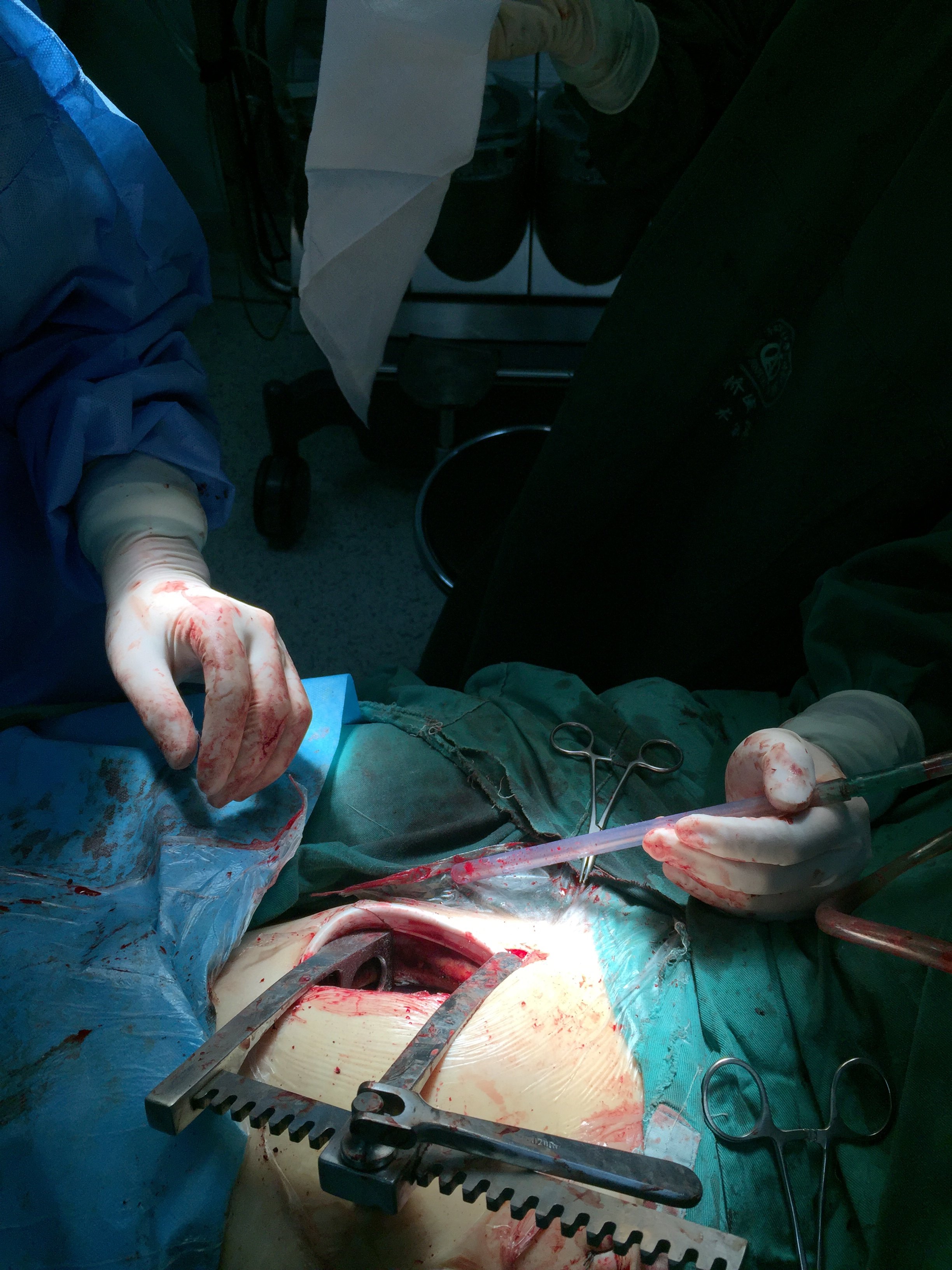 病手术方面出现了不同于传统的正中胸骨切口微创手术,如胸骨旁小切口