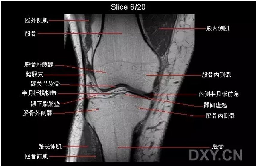 关节影像膝关节的磁共振mri解剖表现