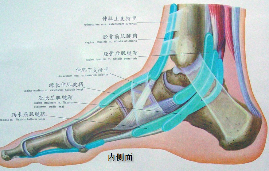 如果胫神经在踝管的近端分为足底内侧神经和足底外侧神经,则容易导致