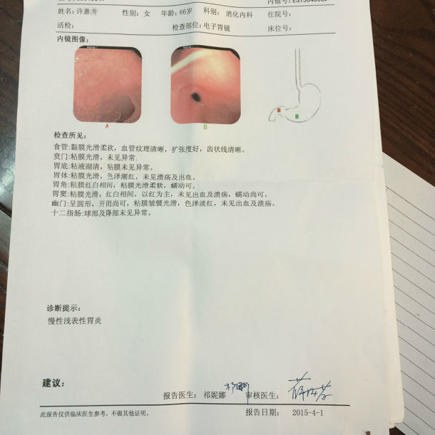 膏方治疗萎缩性胃炎患者的胃镜病理前后对照图片