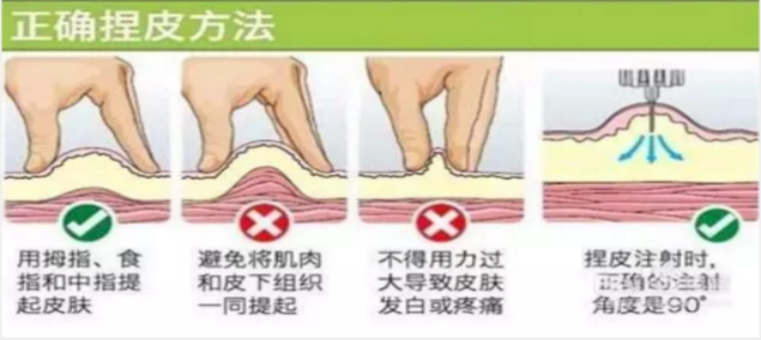 胰岛素注射的方法及技巧