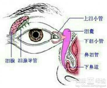 新生儿泪囊炎的按摩方法