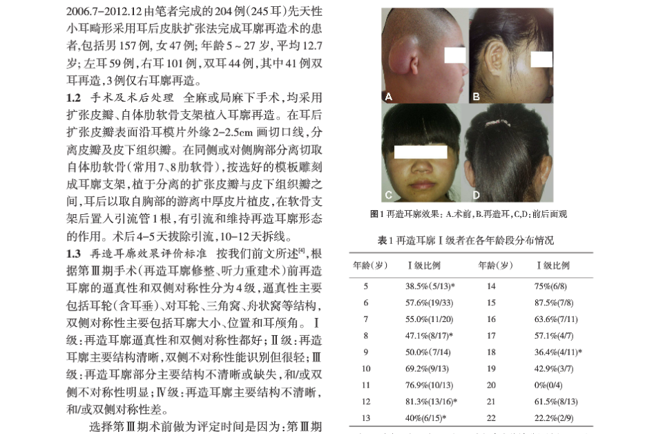 小耳畸形的发展历史及关键技术变革-八大处整形