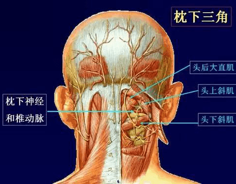 在临床中还有一种非常典型的头痛叫枕大神经痛,就是枕大神经受到肌肉