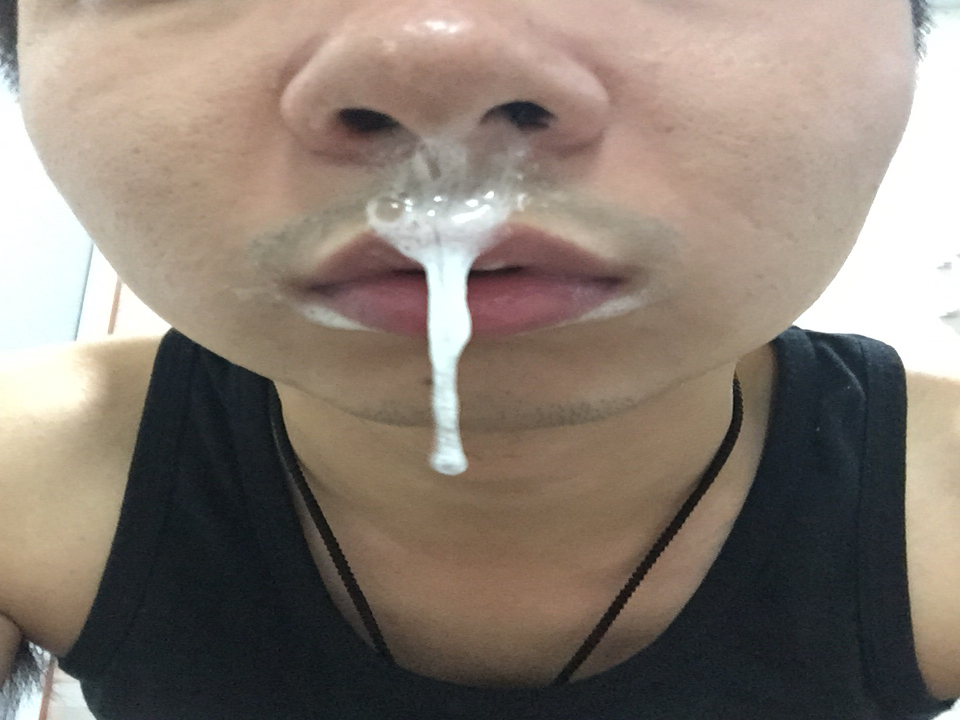 鼻后滴流综合征 www.guahao.com