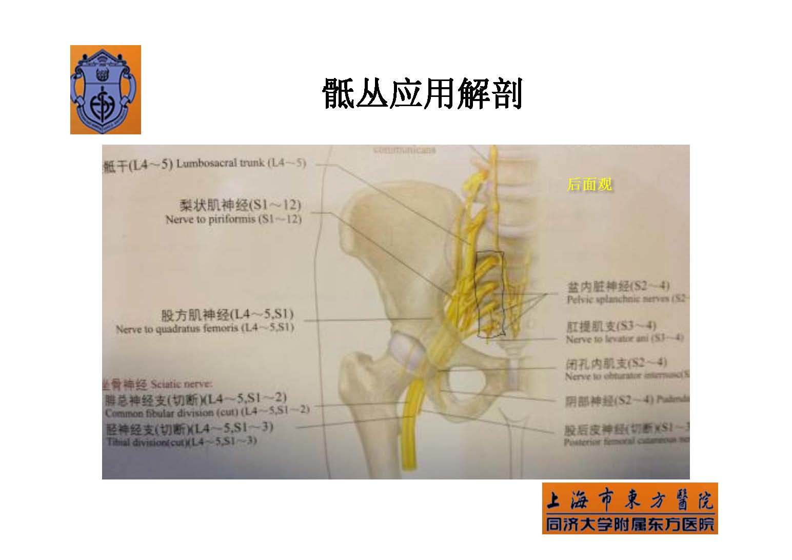 实用骶丛神经阻滞