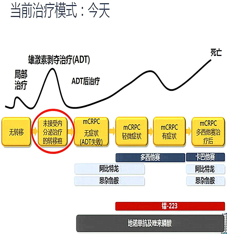 肾癌转移检查_肾癌转移_肾癌的转移