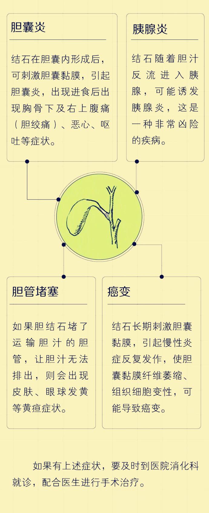 消化科医生提示你胆结石其实可能距离你并不遥远