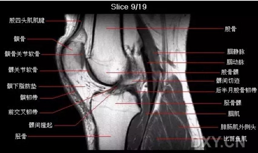 关节影像膝关节的磁共振mri解剖表现