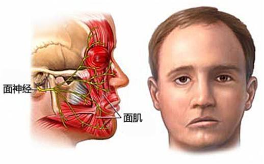 面神经痉挛 www.guahao.com