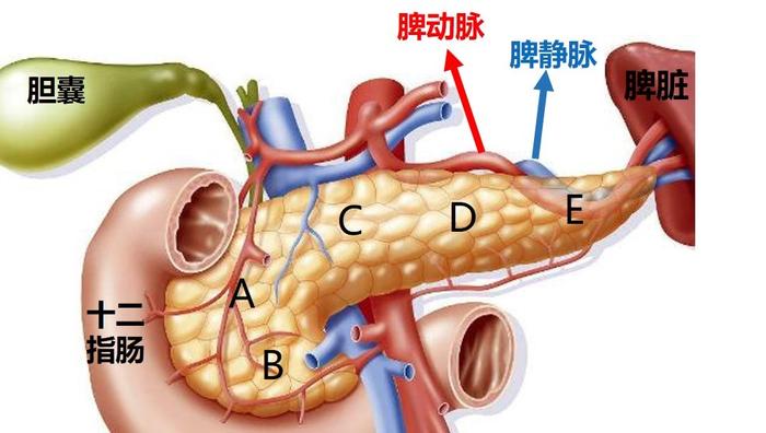 胰体尾肿瘤手术时要切除脾脏吗