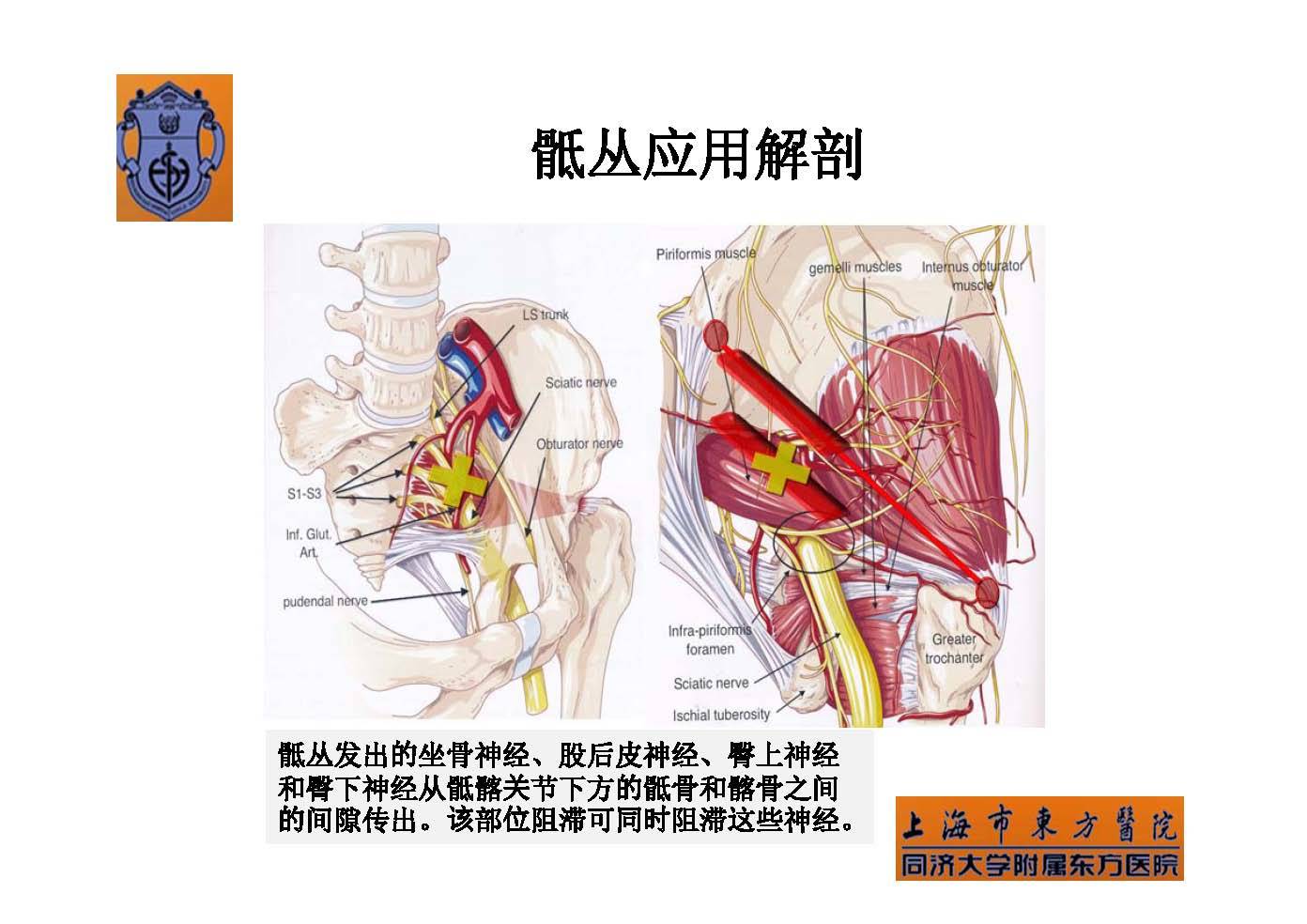 实用骶丛神经阻滞