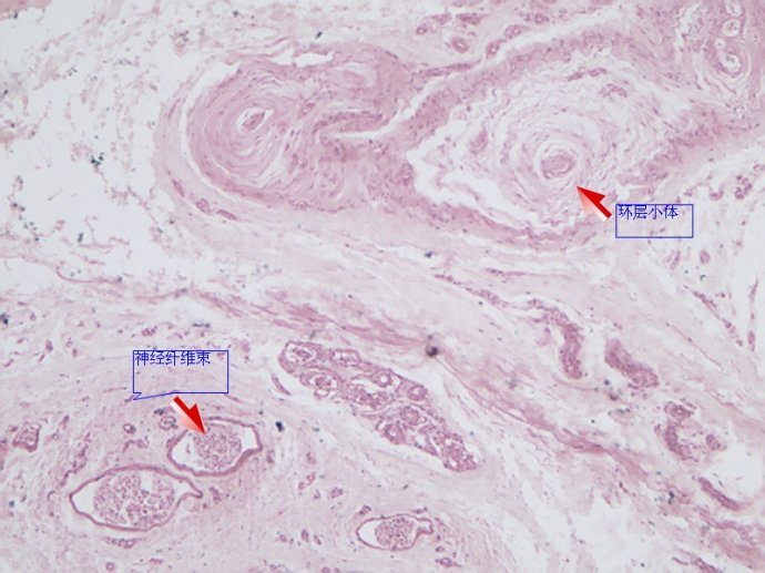 (2)环层小体(lamellar corpuscle):又称潘申尼小体(pacinian