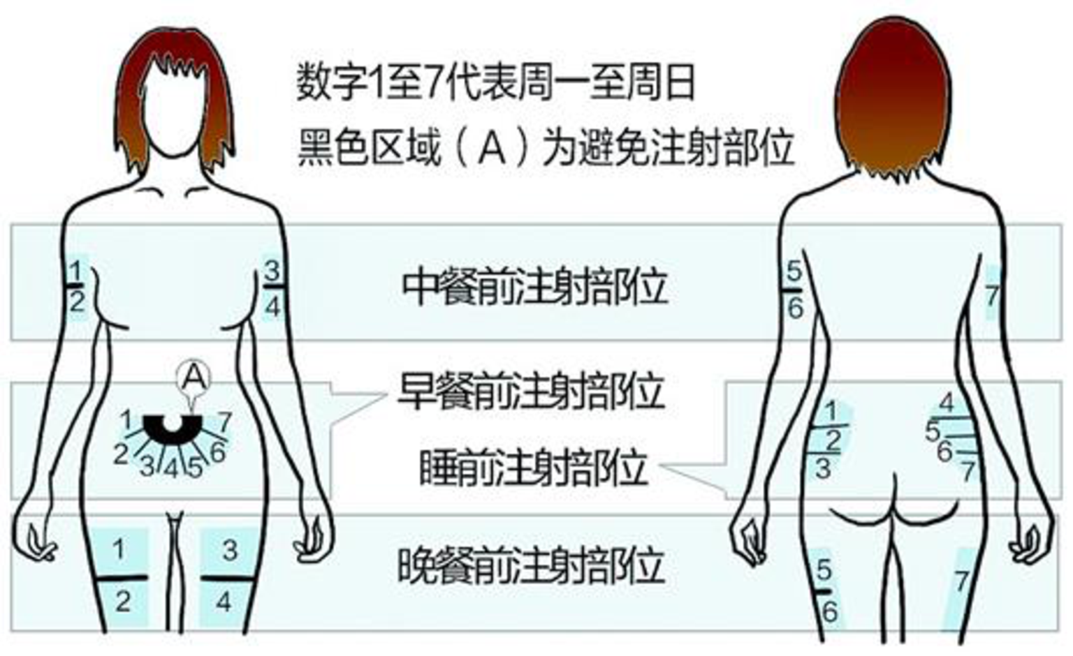 胰岛素注射的方法及技巧