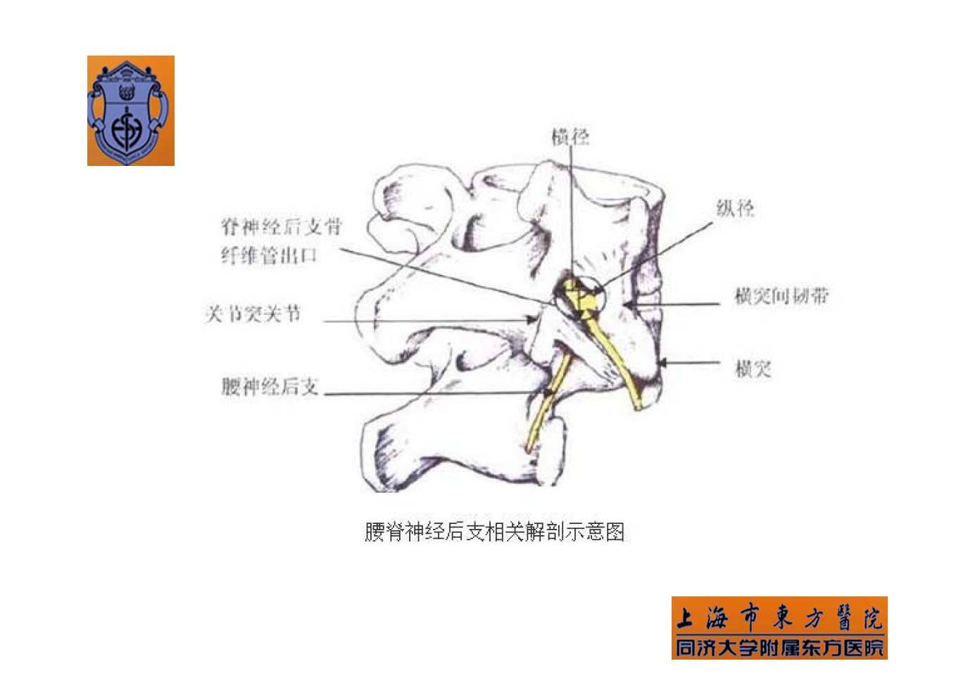 实用腰椎椎旁神经阻滞