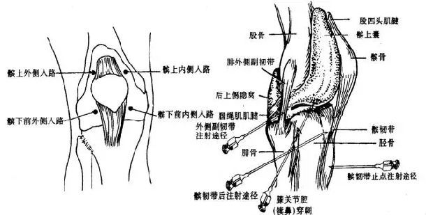 髋膝踝肩肘腕关节穿刺图文详解