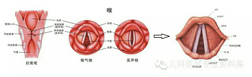 这种情况门诊时有遇到,叫喉软化症(laryngomalacia),也叫喉软骨软化