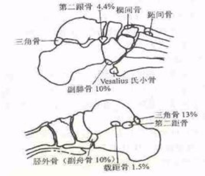 跗骨与小骨小腿横韧带和十字韧带腓骨肌腱上下支持带内侧支持带足踝