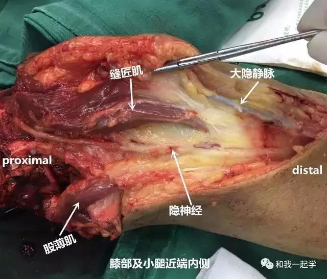 韧带解剖鹅足的解剖结构显示