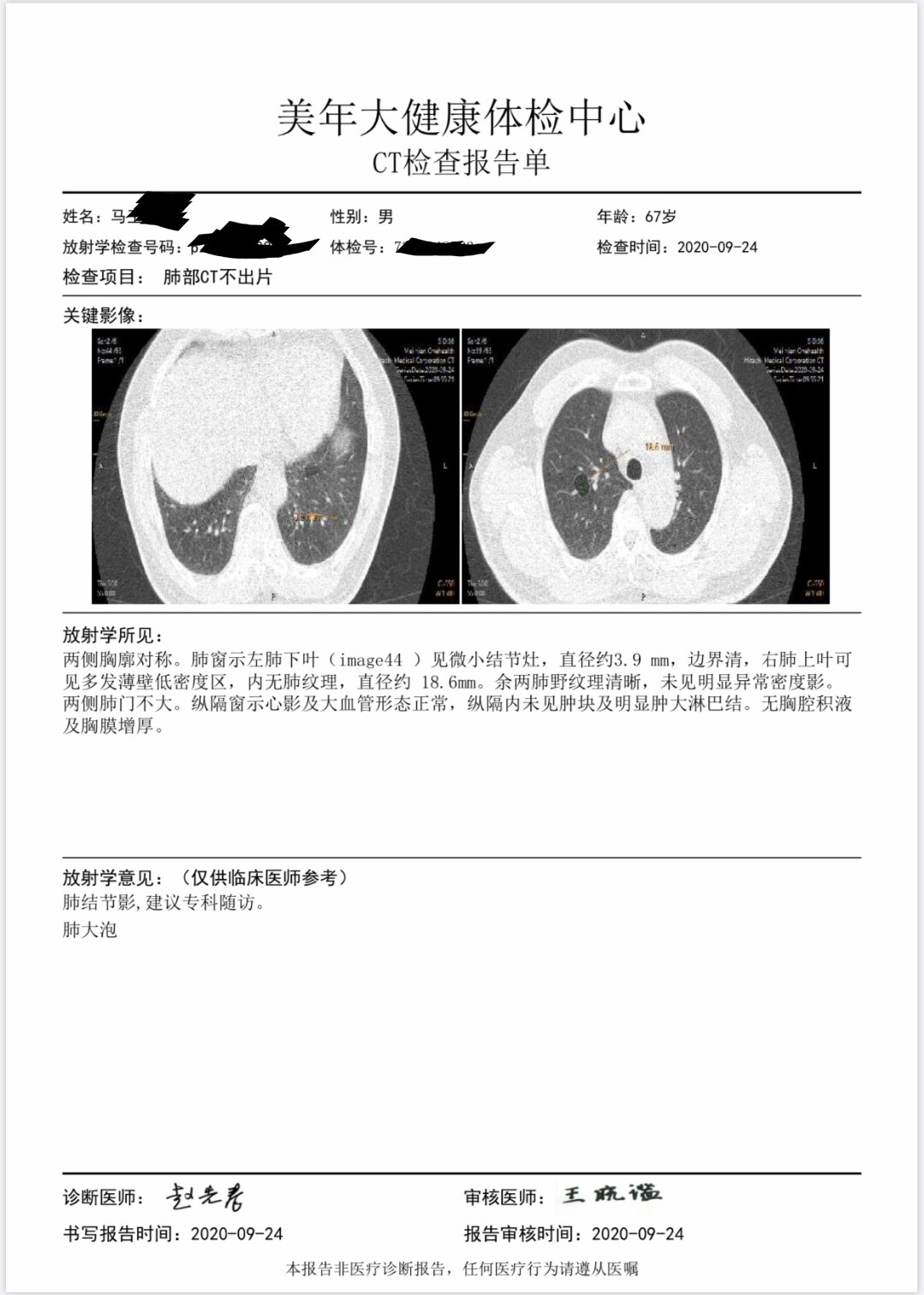 另外,有肺大泡的朋友们平时生活中要注意,有些活动和动作尽量少做
