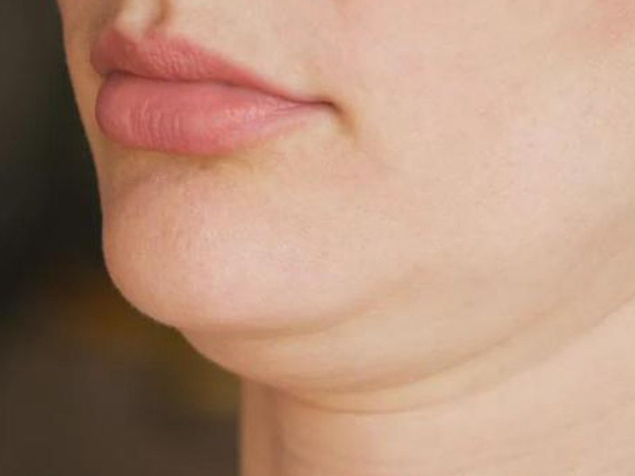 双下巴和下颌缘有什么不同?
