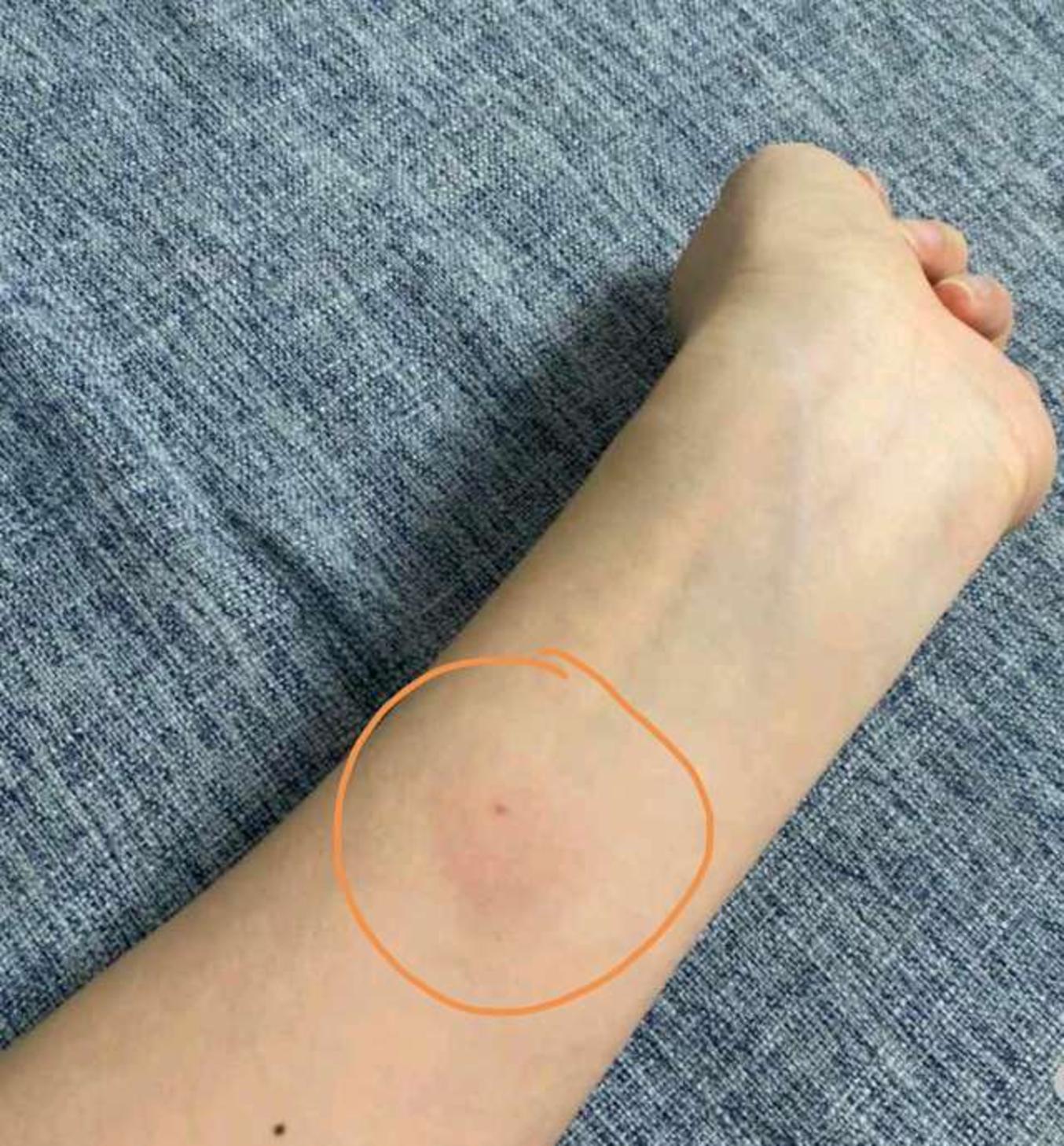 關(guān)于安貞醫(yī)院黃牛加號說到必須做到的信息