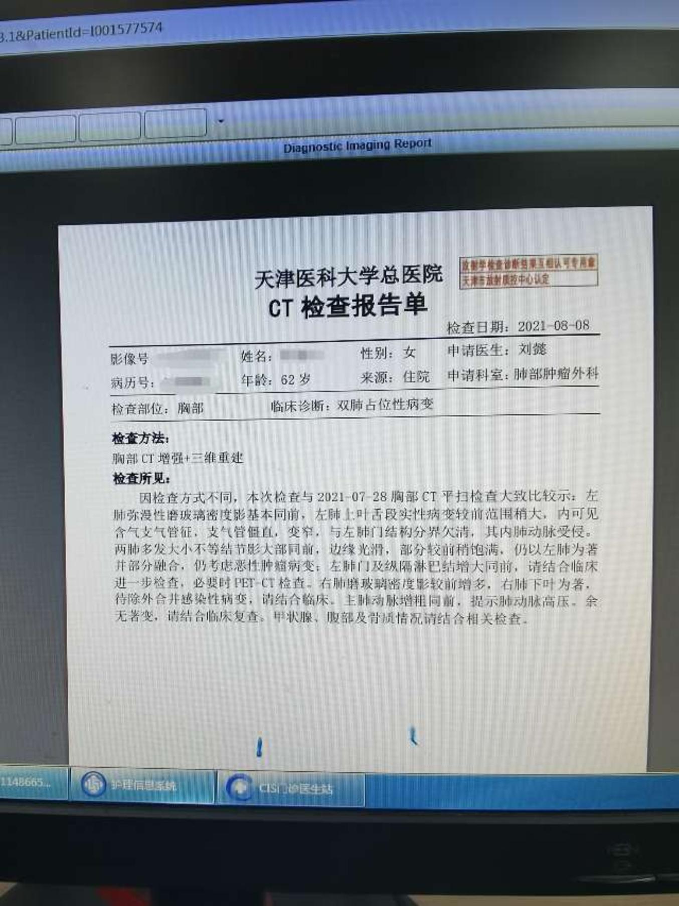 刘懿博士说肺癌二亖九六一直咳嗽了亖个月最后查出来晚期肺癌