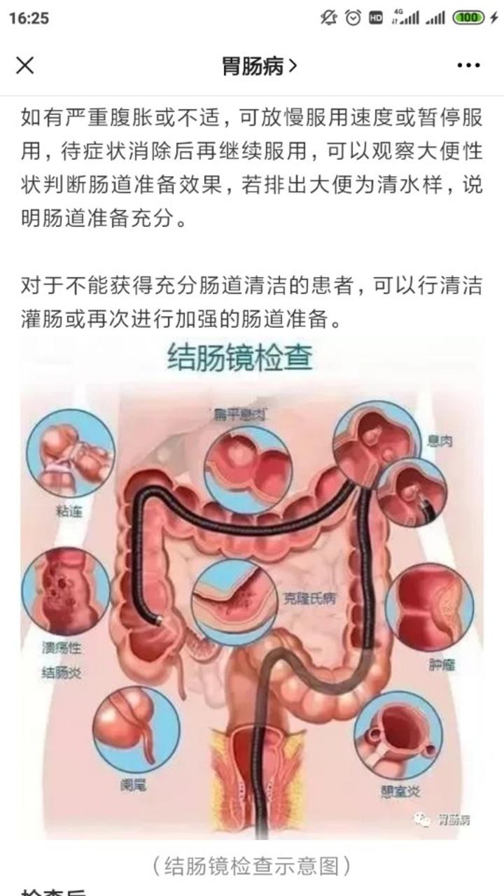 带你认识肠镜检查前后注意事项