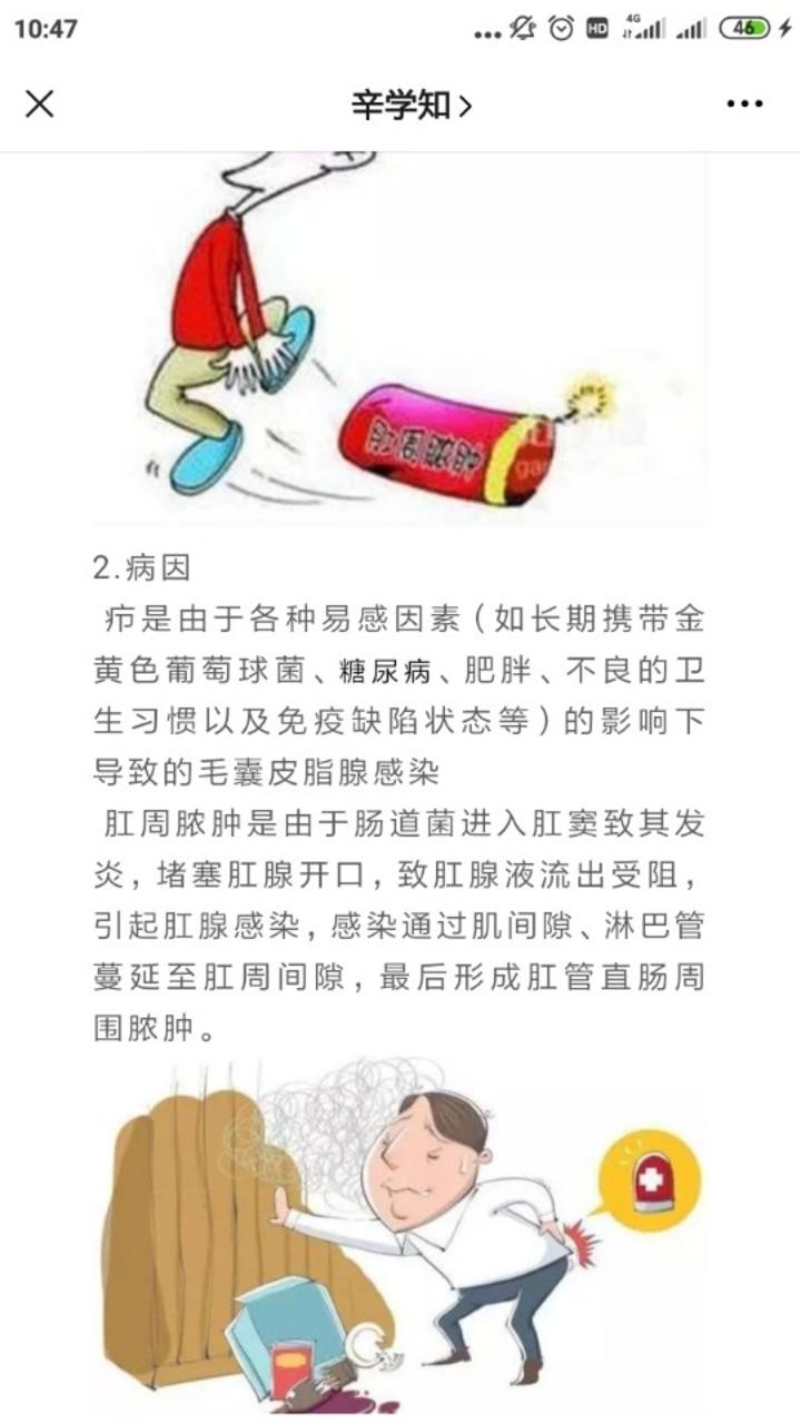 肛周脓肿和疖子如何区分