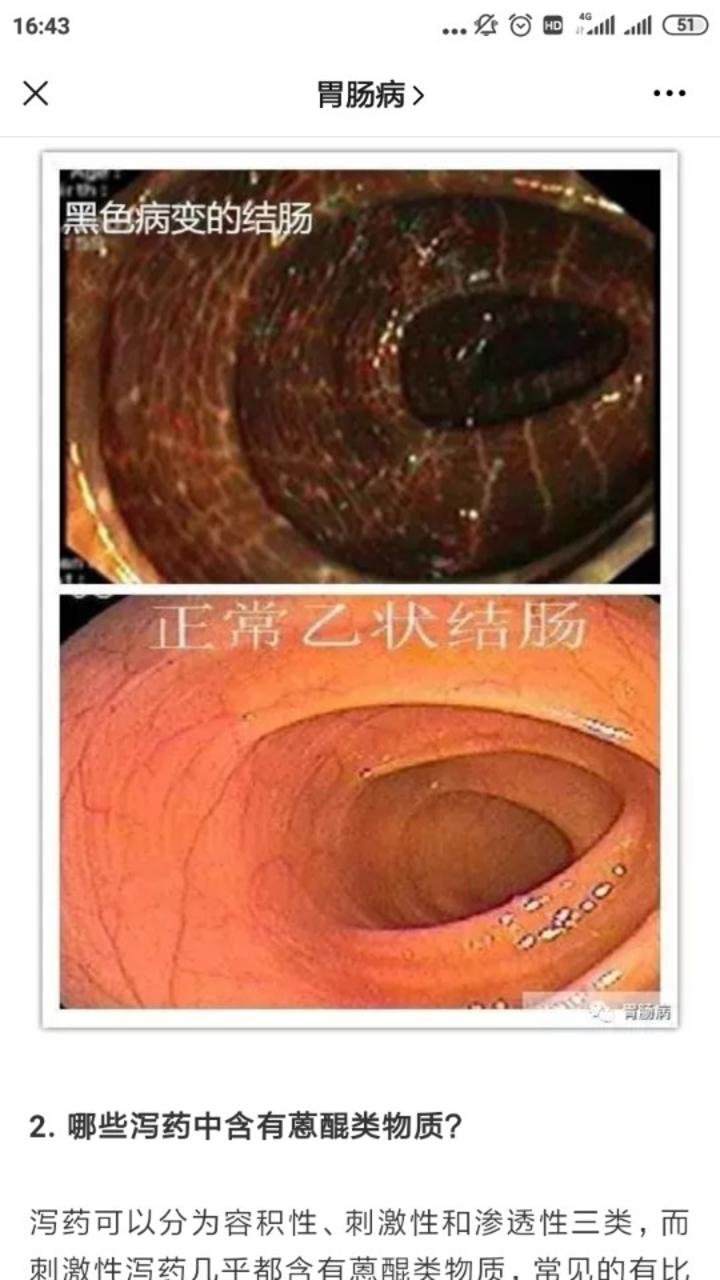 擅长:对肛门直肠良性疾病手术治