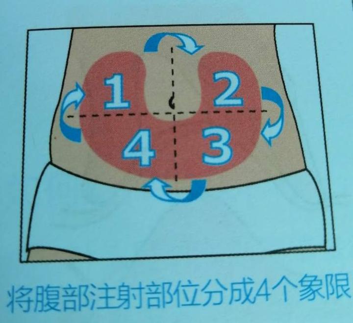 可以将腹部注射部位分成4个象限,大腿或臀部注射部位等分为2个象限