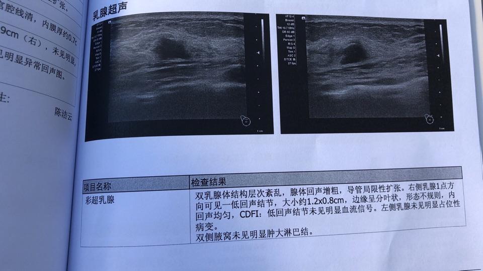 乳腺结节4a类需要做活检吗