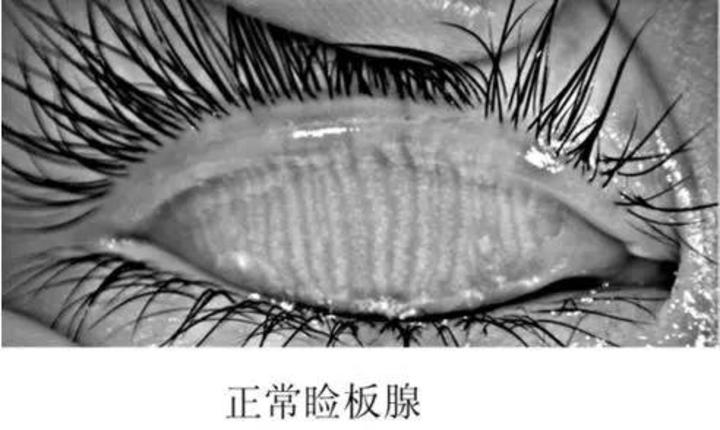 妈妈我眼睛上好像长东西呢