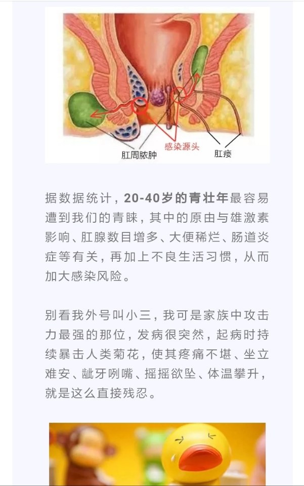 肛周脓肿的真情自白