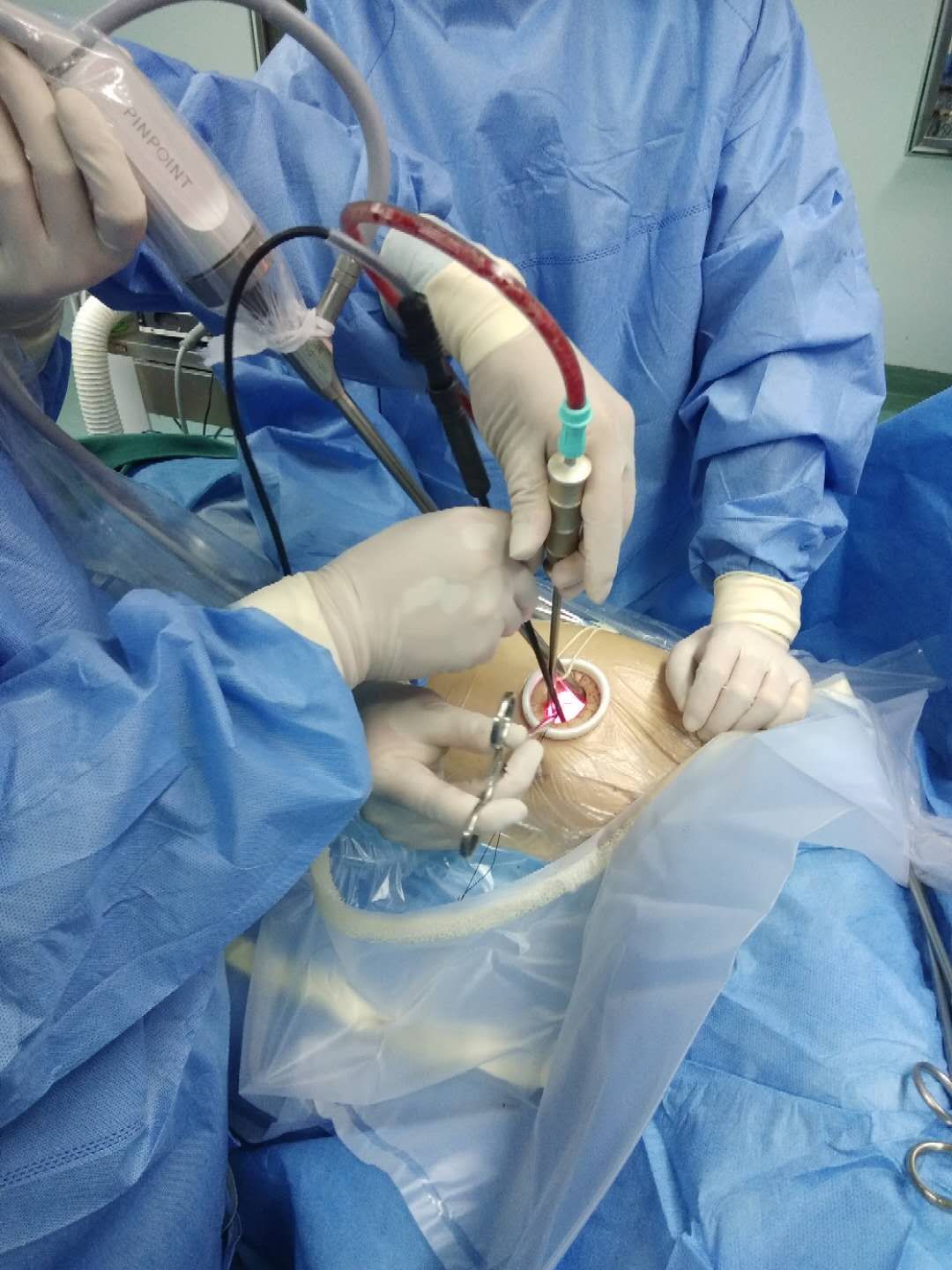 单孔胸腔镜手术的优势及我院手术体系