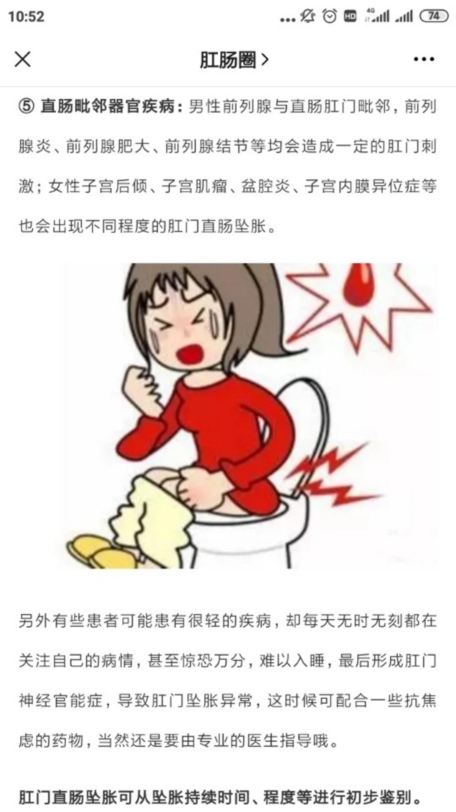 带你认识令人讨厌的肛门坠胀