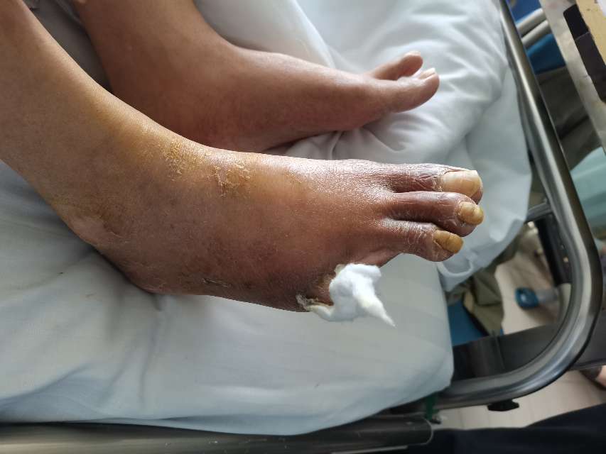 认识手术后慢性疼痛 - 微医(挂号网)