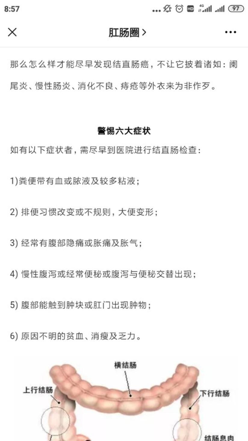 警惕伪装成阑尾炎的结肠癌 健康号 微医