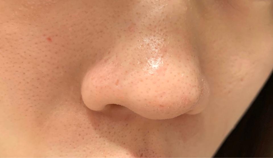 脂质微丝是什东东