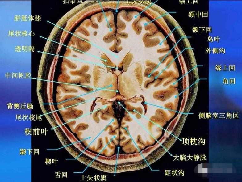 脑的水平切面图.中枢神经包括位于颅腔的脑和位于椎管的脊髓.