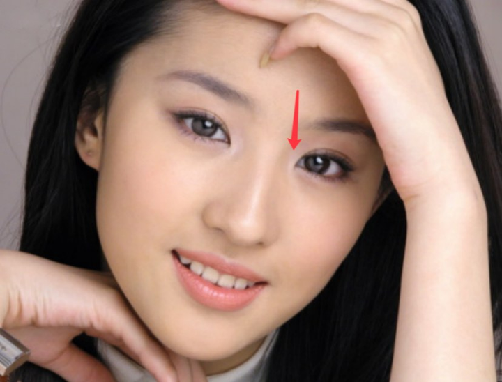 还有刘亦菲这样的,也很漂亮而轻微的内眦赘皮是不会对审美有影响,例如
