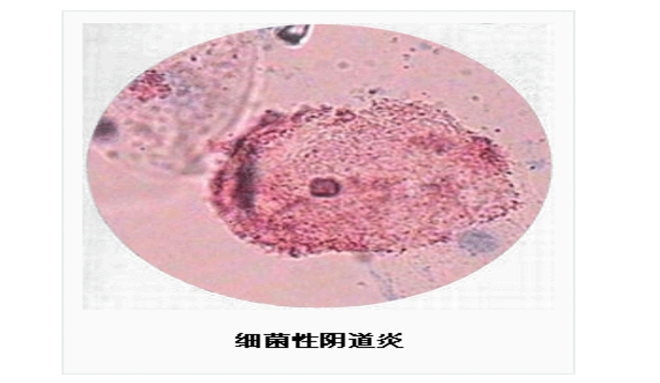 保阴洁女人必须知道的女性健康常识