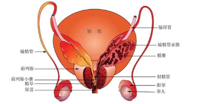 体检发现前列腺囊肿原因是什么