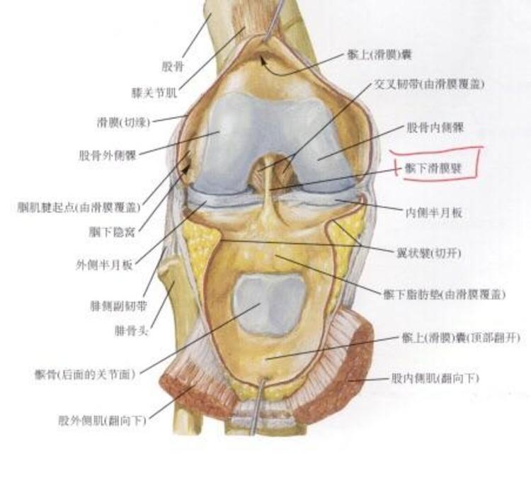 原因四:滑膜皺襞綜合徵這是一種異常半月板,圓盤形,又大又厚,在膝關節