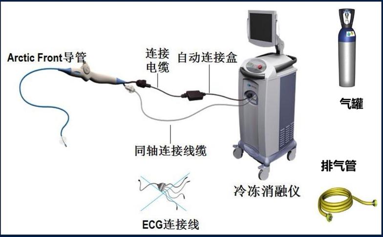 房颤冷冻消融的基本原理