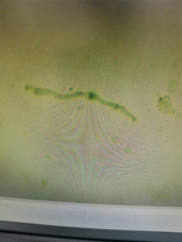 各种皮肤真菌感染性疾病的照片