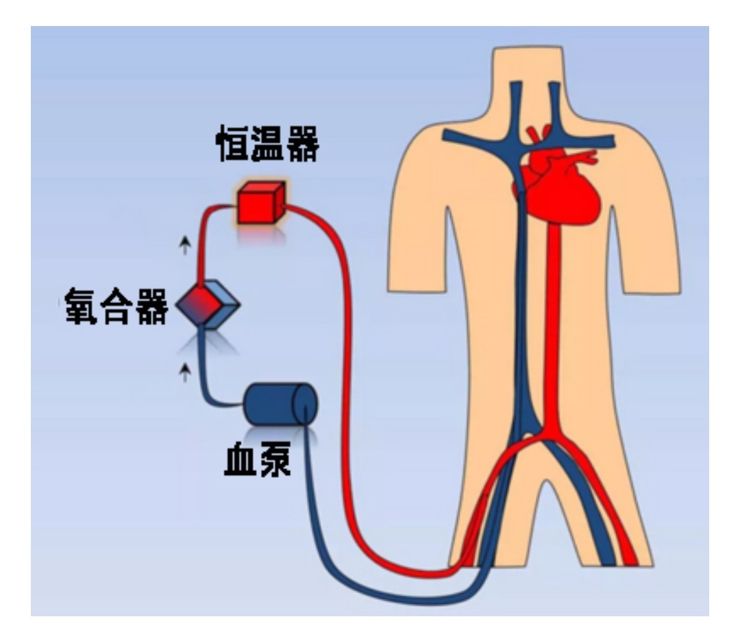 抵御新冠肺炎的尖兵-人工心肺仪(ecmo) - 微医(挂号网)